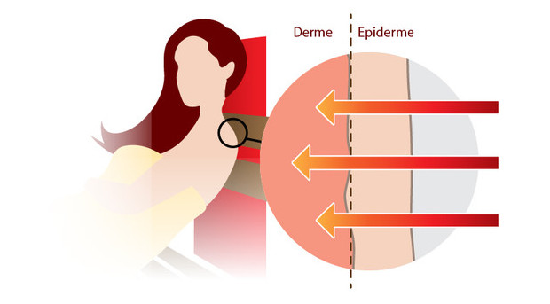 sauna infrarouge - rayonnement direct sur la peau